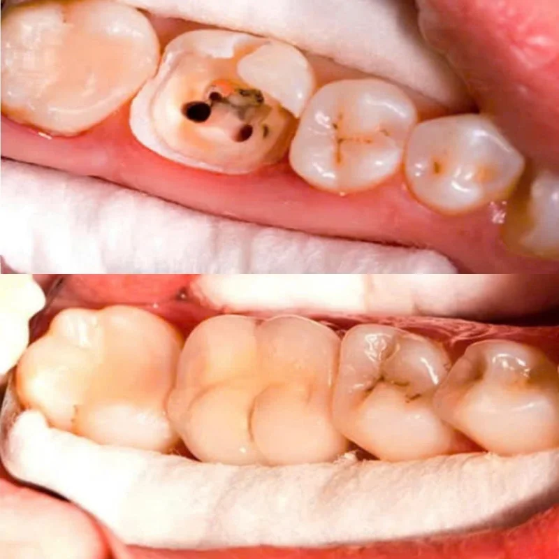 ĐIỀU TRỊ TỦY
